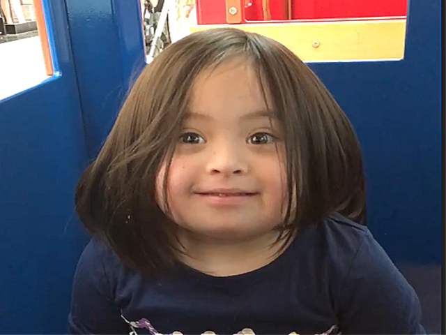 Erick: Down syndrome